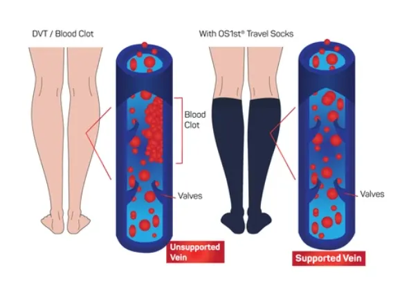 OS1st Travel Compression Socks- Natural